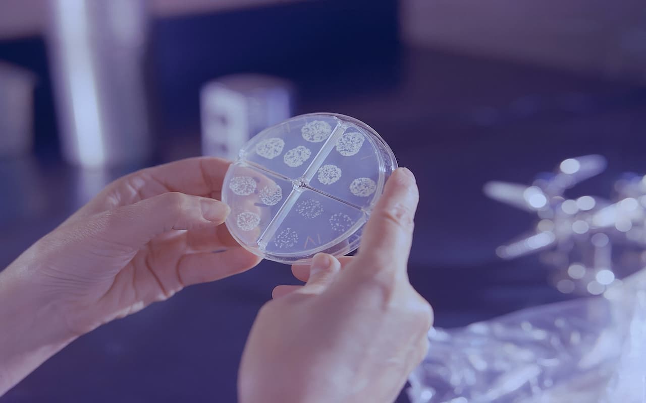 Does Your Travel or Aid Work Plan Require a TB Vaccination?